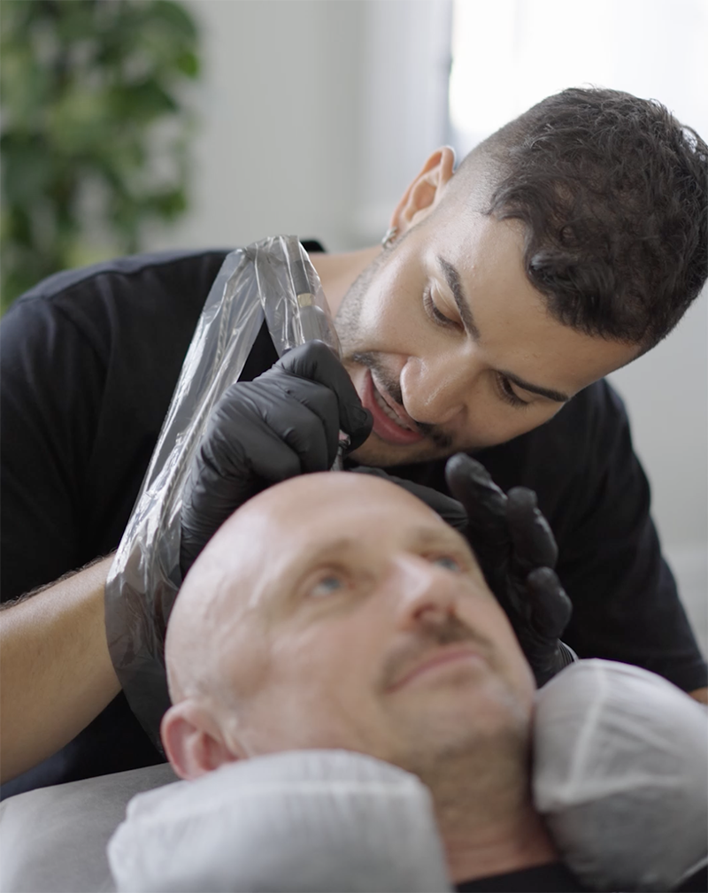 Scalp Micropigmentation Pre-treatment and Aftercare