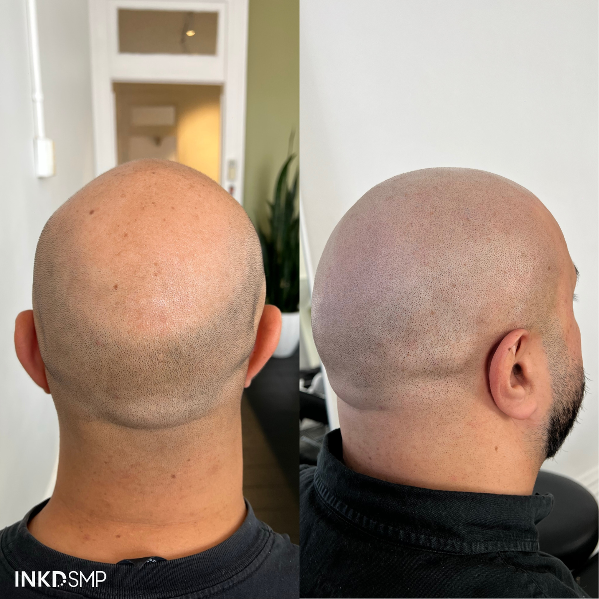 smp=hair-treatment
