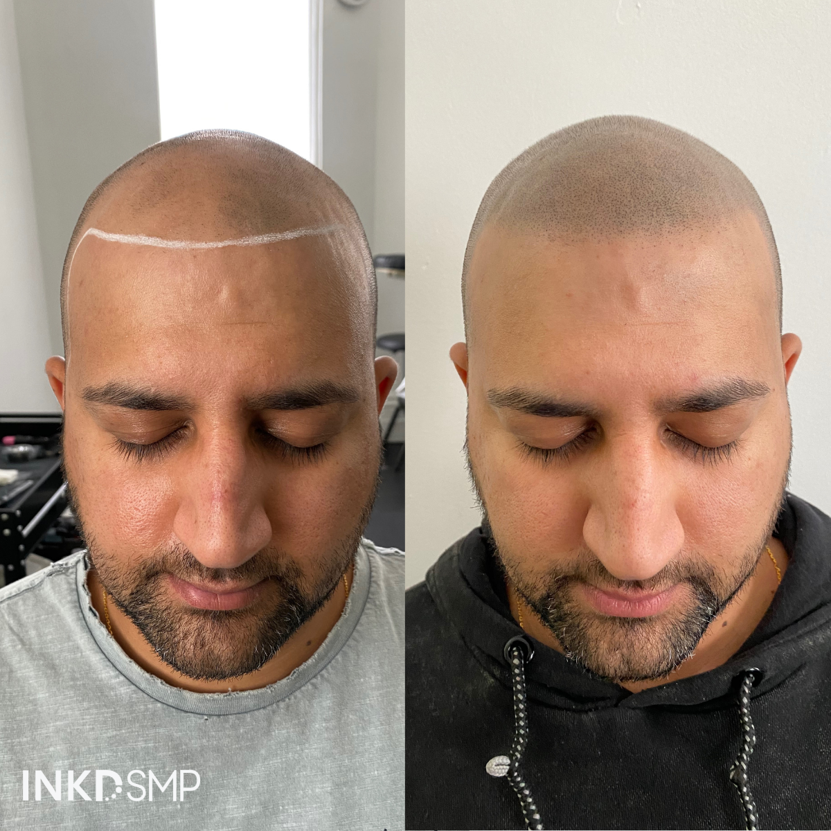 natural-smp-melbourne