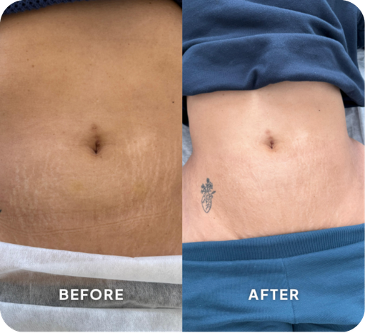 Beauty Treatments at Inkd SMP
